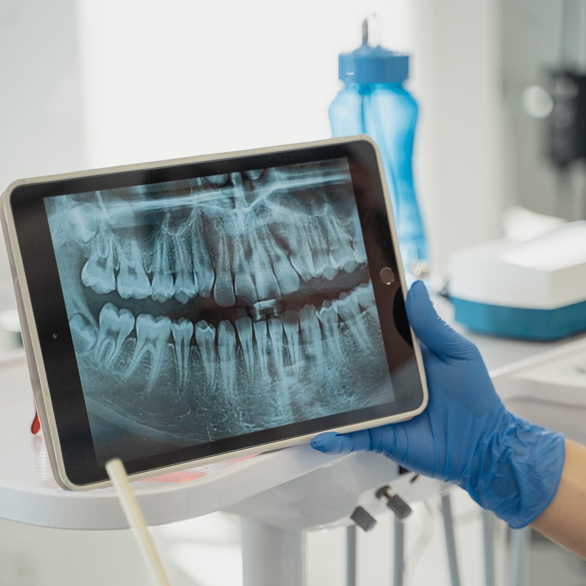 Digital X-Rays