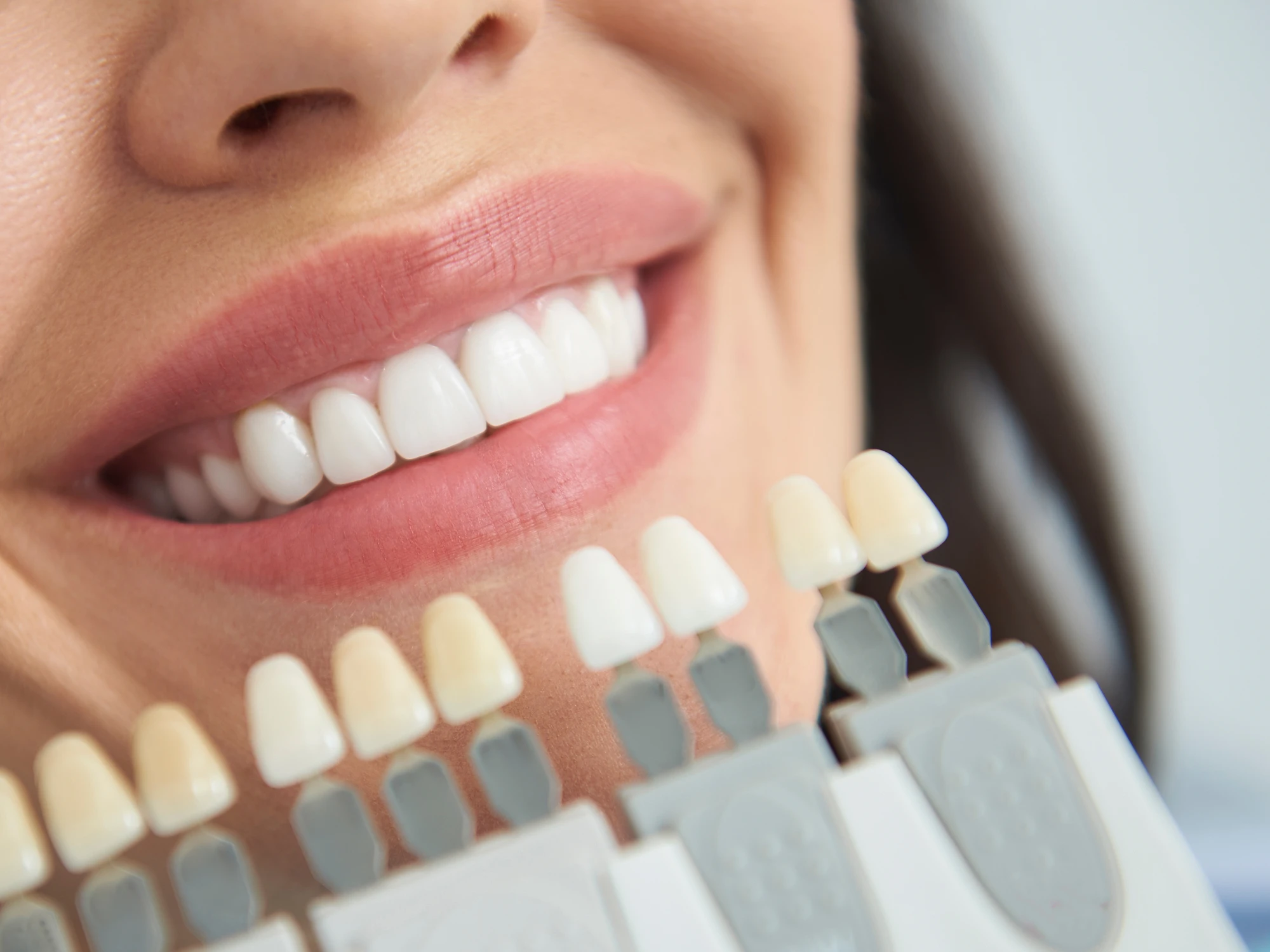 Whitening